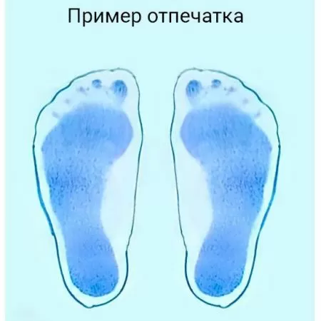 Плантограф TAGLER для определения плоскостопия