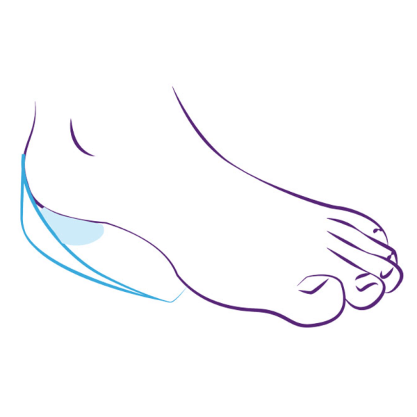 Подпяточники ортопедические Тривес СТ-41 силиконовые с бортиками, пара  